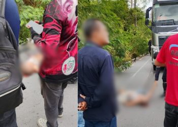 Mulher sofre fratura grave após ser atropelada por carreta na zona leste de Manaus