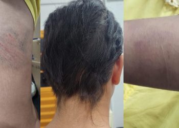 Mãe é presa por cortar cabelo da filha de 13 anos com faca e agredi-lá em Manaus